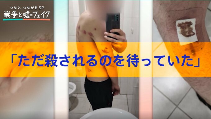 「ただ殺されるのを待っていた。こめかみに銃を突き付けられ…」ロシア軍の捕虜となったウクライナ兵が語った恐ろしい体験【国山ハセンキャスター取材】|TBS NEWS DIG