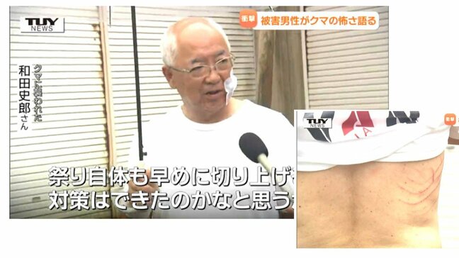 クマに襲われ必死に抵抗した男性が語る”クマとの格闘”　体には生々しいキズ…「子どもだったら大変だった」クマ対策は待ったなしか（山形）|TBS NEWS DIG