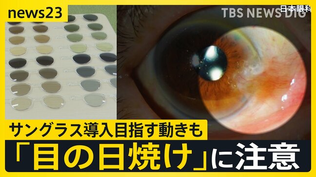 続く猛暑…「目の日焼け」に注意　子どものサングラスどう思う？　校則で禁止の学校がある一方で制服にサングラス導入目指す動きも【news23】|TBS NEWS DIG