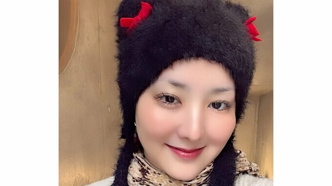 【がん闘病】希良梨さん「CTを撮らないといけなくて、正直、怖いです…」「他に、転移してたらどうしようとか、嫌な感情に襲われてしまう」心境を明かす|TBS NEWS DIG