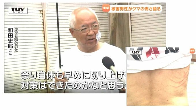 クマに襲われ必死に抵抗した男性が語る”クマとの格闘”　体には生々しいキズ…「子どもだったら大変だった」クマ対策は待ったなしか（山形）|TBS NEWS DIG