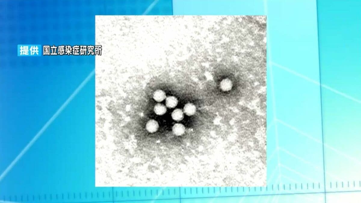 手足口病の感染者351人で9週連続増加 鹿児島 | 鹿児島のニュース｜MBC