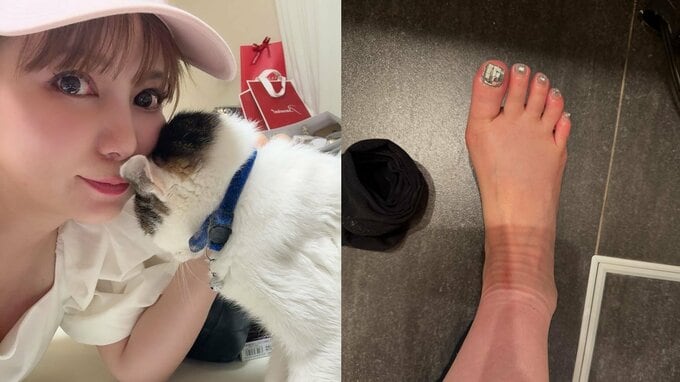【中川翔子】「べつじんのあし！！」むくみ撃退「減塩自炊と着圧ソックス」　身体と心の平安に “SNSは好きなことや猫やおいしいかわいい”|TBS NEWS DIG