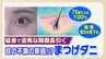 「目がゴロゴロする」原因は「まつ毛ダニ」かも　メイクの落とし忘れに要注意！　|　福岡のニュース｜RKB NEWS｜RKB毎日放送