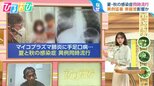 「マイコプラズマ肺炎」「手足口病」夏・秋の感染症が同時流行 「インフルエンザ」早めのワクチン接種を【ひるおび】|TBS NEWS DIG