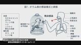 「オウム病」の疑いで30代の妊婦が死亡 鳥の糞など主な感染経路も 女性は家庭内で 鳥 飼育せず 専門家「野鳥からも感染の可能性」 | 長崎のニュース | 天気 | NBC長崎放送