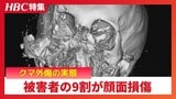 【クマ襲撃】被害者の9割が顔面損傷…鼻がなくなり骨は粉砕「体を大きく見せようと立ち上がって…」医師が語るクマ外傷の実態 47歳男性はあの日を境に人生が一変|TBS NEWS DIG
