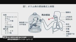 「オウム病」の疑いで30代の妊婦が死亡 鳥の糞など主な感染経路も 女性は家庭内で 鳥 飼育せず 専門家「野鳥からも感染の可能性」|TBS NEWS DIG