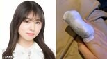 AKB48・岩立沙穂さん 靭帯損傷で劇場公演を欠席 右手指にギプス「人差し指の靭帯損傷と診断」「申し訳ない気持ちでいっぱい」|TBS NEWS DIG