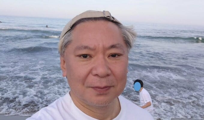 【 鈴木おさむ 】 「歯茎の状態わるく、前歯二本抜歯！」　更に手術も　「自分の血液で作った歯の素的なものを歯茎に入れる手術を行うことになる」|TBS NEWS DIG