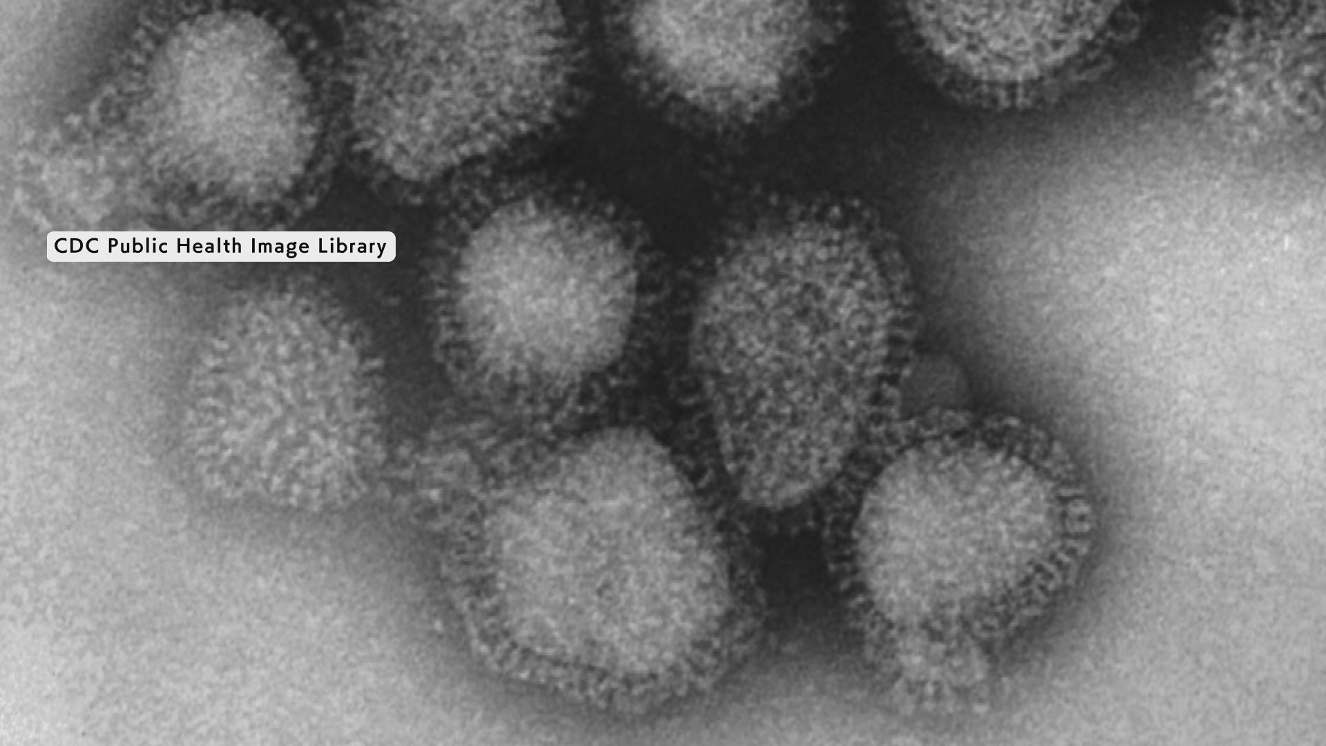 過去10年間で最悪】インフル道内で猛威 定点医療機関の報告数61.78人