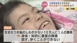 「さっちゃん津波きたよ!逃げるよ」医療的ケア児など「災害弱者」どう守る?そのとき何が必要?どこに逃げる?行政・地域住民と避難訓練 | 富山のニュース|天気・防災|チューリップテレビ