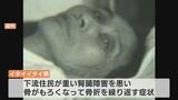 四大公害病のひとつ・イタイイタイ病 画期的な「公害防止協定」で今も続く原因企業の立ち入り調査 弁護士、科学者、住民らが監視の目|TBS NEWS DIG