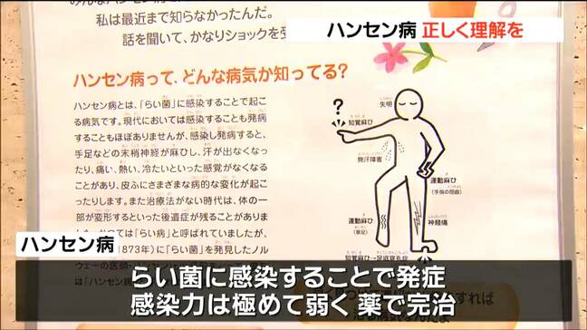 「いまだに県民にも偏見がある」ハンセン病の“正しい理解”を呼びかけるパネル展開催　宮城|TBS NEWS DIG