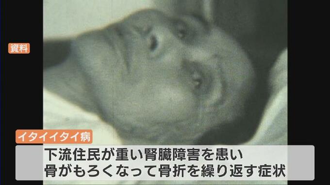 四大公害病のひとつ・イタイイタイ病　画期的な「公害防止協定」で今も続く原因企業の立ち入り調査　弁護士、科学者、住民らが監視の目|TBS NEWS DIG