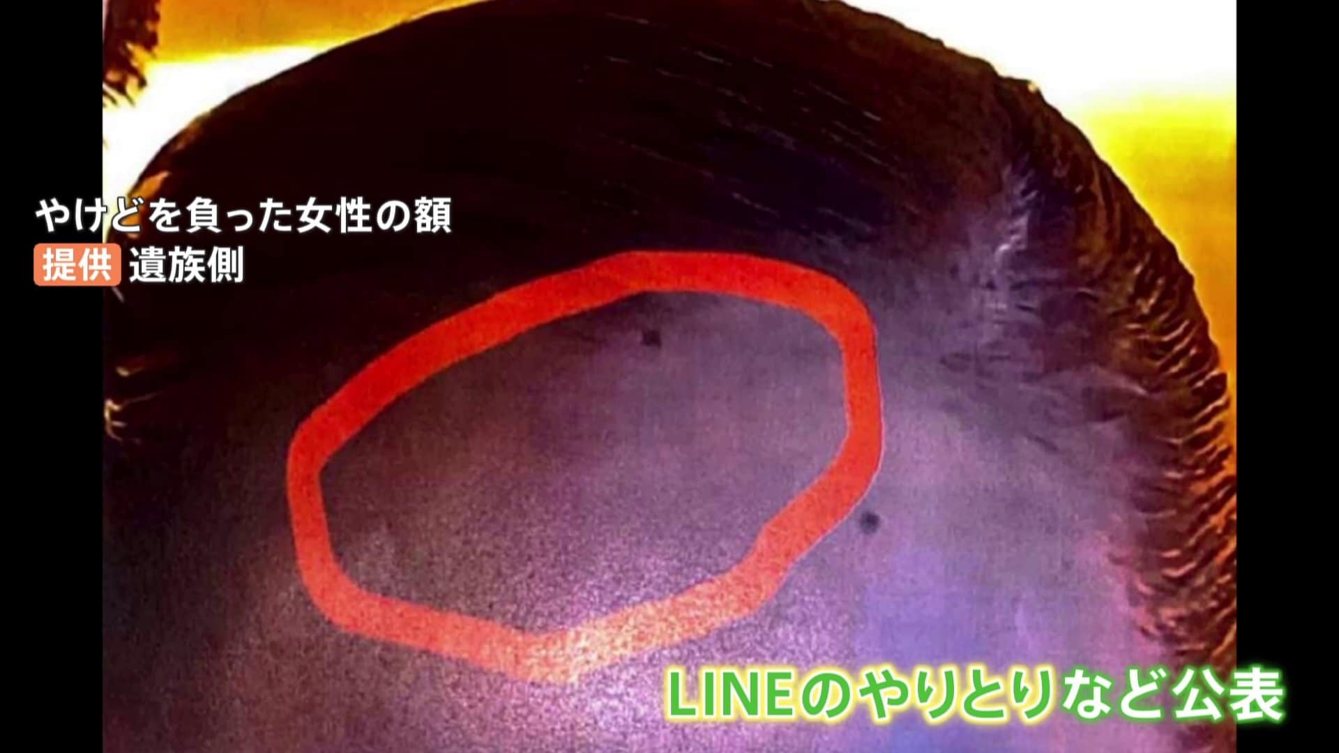 宝塚歌劇団 宙組 死亡