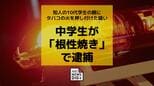 中学生が「根性焼き」で逮捕 知人の10代学生の腕にタバコの火を押し付けた疑い【長崎】　|　長崎のニュース | 天気 | NBC長崎放送