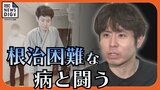 30代前半で人工肛門造設のオストメイトに　国指定難病「クローン病」と歩む男性 「ケア、対策で旅行も趣味も」|TBS NEWS DIG