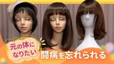 選択肢の増える「ウィッグ」や「人工乳房」がん患者の苦痛を和らげる“アピアランスケア”に補助金を出す自治体も | 福岡のニュース|RKB NEWS|RKB毎日放送