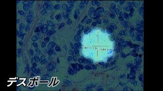 「デスボール」原爆の放射線が体内に留まり細胞に“穴”を　最新の研究発表が波紋…長崎原爆から81年　置き去りの被爆体験者【NO WARプロジェクト つなぐ、つながる】|TBS NEWS DIG