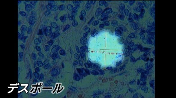「デスボール」原爆の放射線が体内に留まり細胞に“穴”を 最新の研究発表が波紋…長崎原爆から81年 置き去りの被爆体験者【NO WARプロジェクト つなぐ、つながる】|TBS NEWS DIG