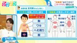 『汗くさい』はなぜ起こる?大人も「あせも」に注意!今すぐ始める汗対策【ひるおび】|TBS NEWS DIG