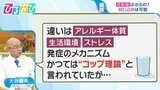 「花粉症になる人・ならない人の違いは？」「花粉症は日本だけ？」素朴なギモンを医師に聞く【ひるおび】|TBS NEWS DIG