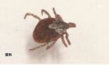 マダニ媒介の感染症「SFTS」患者 県内で2026年2人目確認 県が注意呼びかけ＝静岡県|TBS NEWS DIG