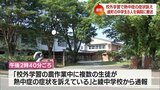 綾町で校外学習中の中学生9人が熱中症の症状訴え　8人が病院に搬送|TBS NEWS DIG
