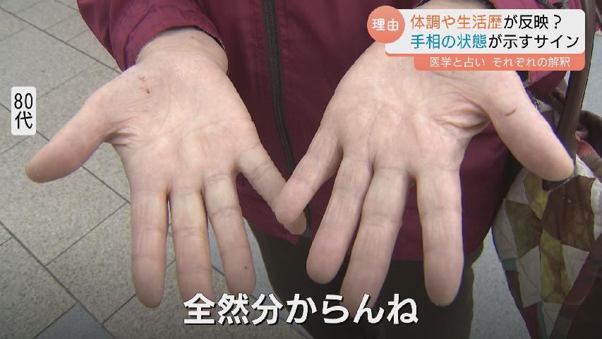 手相が変わる」ってホント？ 運勢をみるだけじゃない！手相が示す健康