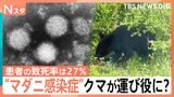 患者の致死率27% “マダニ感染症”SFTSが過去最多ペース クマやアライグマが“運び役”に?【Nスタ】|TBS NEWS DIG