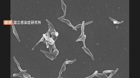 【速報】「マイコプラズマ肺炎」全国の患者数が5週連続で過去最多更新　1医療機関あたりの患者数「2.49人」|TBS NEWS DIG