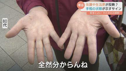 手相が変わる」ってホント？ 運勢をみるだけじゃない！手相が示す健康