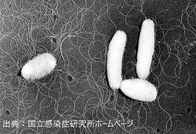 “腸炎ビブリオ” 食中毒で８人が腹痛下痢　宮島対岸の旅館「石亭」に営業禁止処分　広島|TBS NEWS DIG