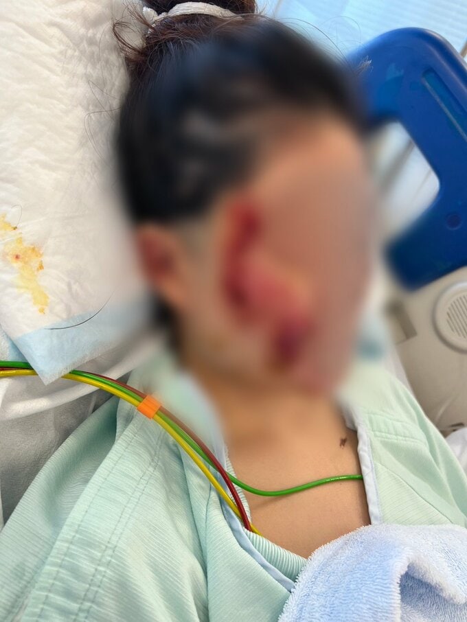 「地獄に突き落とされた感覚。こんな傷だらけになってしまって…」美容が好きだった20代女性　飲酒運転で二度と戻らなくなった顔と身体　念願の留学も白紙に…　被告の28歳女は酒に酔ったままハンドル握り…　危険運転致傷罪で起訴|TBS NEWS DIG