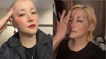 【がん闘病】希良梨さん　抗がん剤による脱毛も「堂々としてればいい」 “充分闘っているのだから” |TBS NEWS DIG