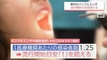 宮崎県内のインフルエンザ感染者数が増加　流行開始の目安超える　昨年より1か月早く　|　MRTニュース ｜ ＭＲＴ宮崎放送