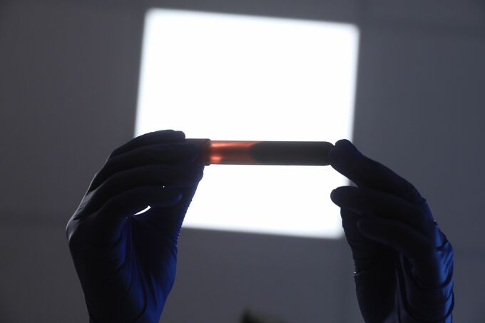 富士レビオのアルツハイマー症検査薬、米国で６月下旬から利用可能に