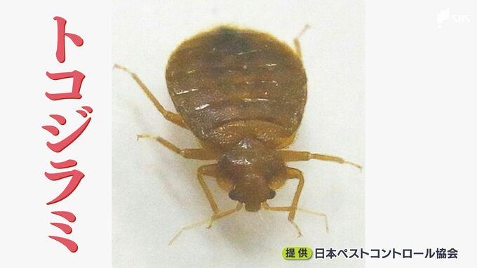 「どんなにきれいにしても…どこにいるのかわからず防ぎようがない」急増「トコジラミ」は寝込みを襲う“ドラキュラ”か? ベッドやソファに“黒いシミ”は危険サイン | 静岡のニュース | SBSNEWS | 静岡放送