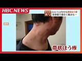 「この痛みは死んだ方がいいかな…」3人に1人が『帯状ほう疹』に…50歳以上発症者の2割に“合併症”2025年度からワクチンの一部公費負担へ | 北海道のニュース|HBC北海道放送
