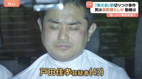 追いかけて複数回切りつけ 「東大前」駅で男(43)が男子大学生(20)を襲って切りつけ殺害しようとしたか 男は長野・生坂村暮らしか|TBS NEWS DIG