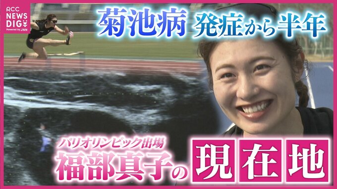 織田陸上欠場の福部真子　「菊池病」発症から半年･･･陸上女子100mハードル日本記録保持者の彼女がいま思うこと　|　RCC NEWS | 広島ニュース | RCC中国放送