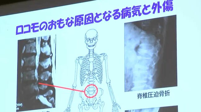 「骨と関節の日(10月8日)」を前に市民公開講座 骨と関節を健康に保とう 負担をかけすぎない軽い運動で維持を【岡山】|TBS NEWS DIG