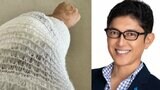 薬丸裕英さん「痛みが治らず」　テニス肘で「ＰＲＰ療法」…「注射部位に腫れと熱が」　痛々しい包帯姿も|TBS NEWS DIG