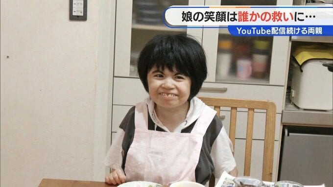 1～3万人に1人 先天性の障害がある娘の姿をYouTubeに「娘の笑顔が誰かの救いになれば」 |TBS NEWS DIG