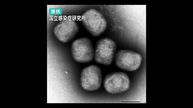 高知県で“サル痘（エムポックス）”患者確認…海外渡航歴ない男性、県内１例目　発熱と発疹で受診|TBS NEWS DIG