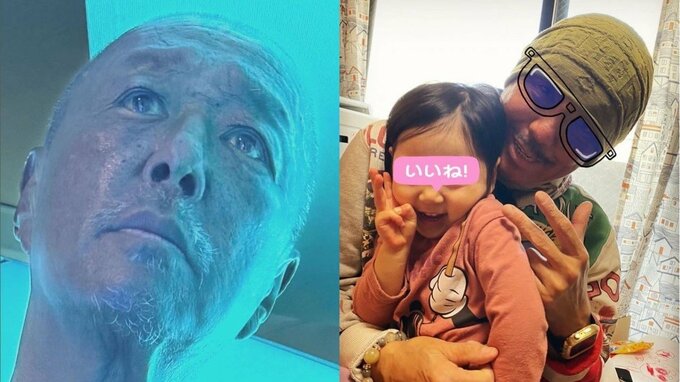 ブラザー・コーンさん「孫の笑顔がこの疾患にはよく効く」治療の近況報告「シラガーコーンでシクヨロ」|TBS NEWS DIG
