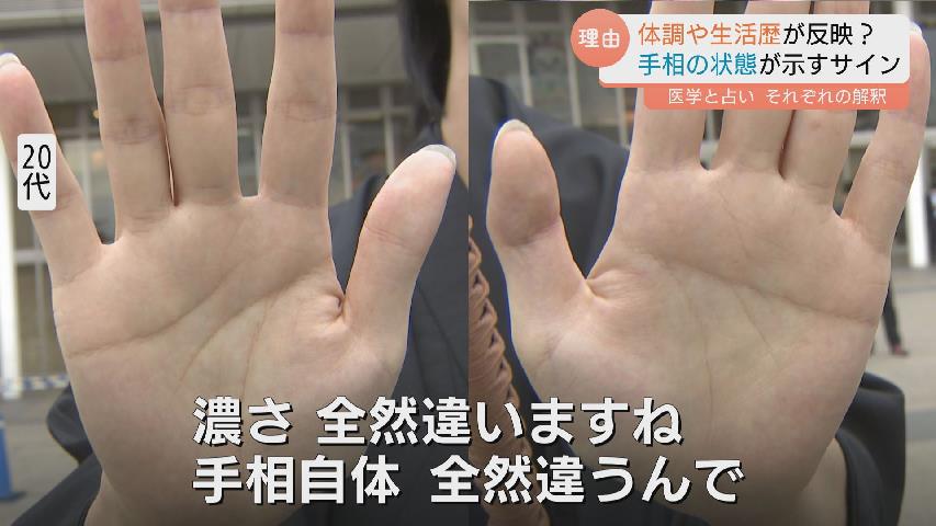 手相が変わる」ってホント？ 運勢をみるだけじゃない！手相が示す健康