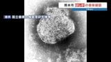 【はしか】熊本市で7年ぶりの感染者、県外からの転居後に発症 全国では急増525人で去年の2倍近くに | 熊本のニュース|RKK NEWS|RKK熊本放送