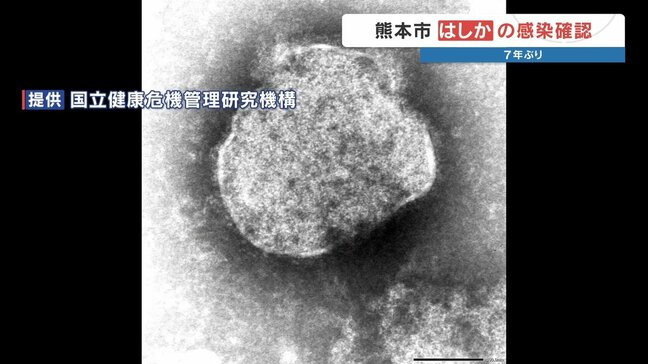 【はしか】熊本市で7年ぶりの感染者、県外からの転居後に発症 全国では急増525人で去年の2倍近くに|TBS NEWS DIG